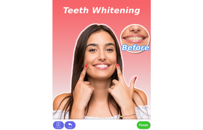 teeth whitening before